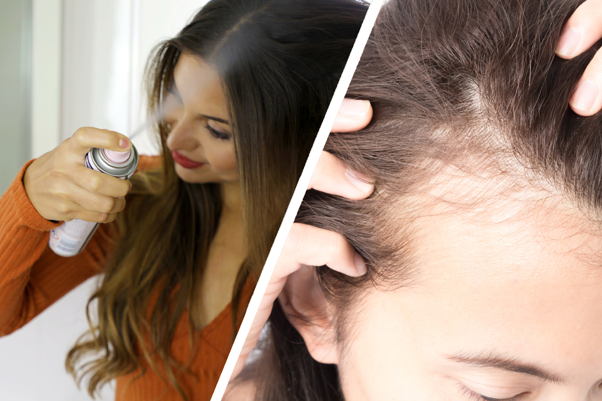 Ultra-Hold Hairspray Leads To Hair Loss