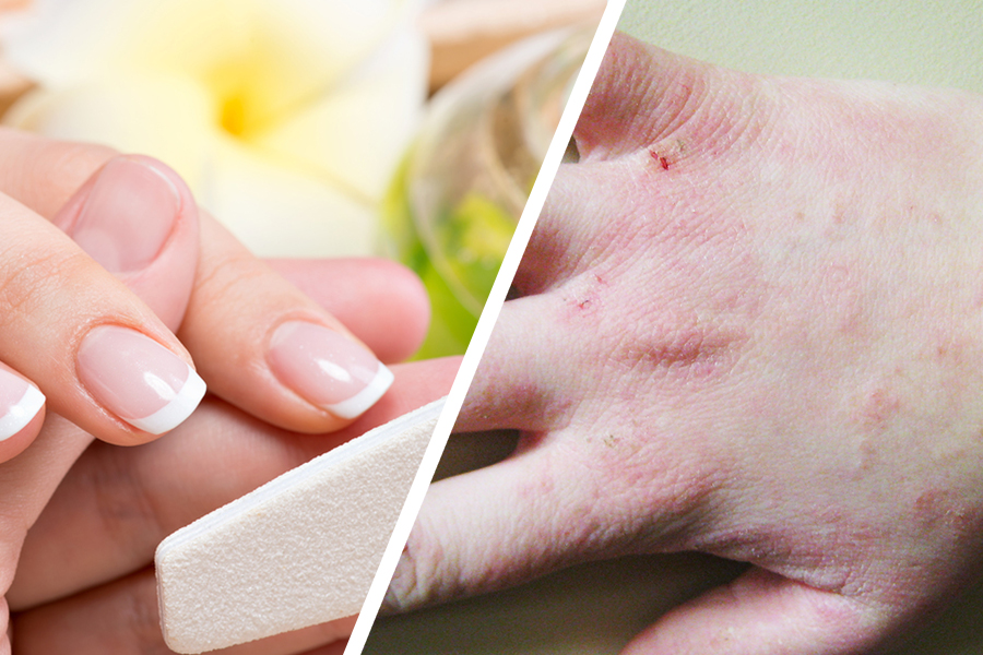 Gel Manicures Can Lead To Skin Damage And Cancer
