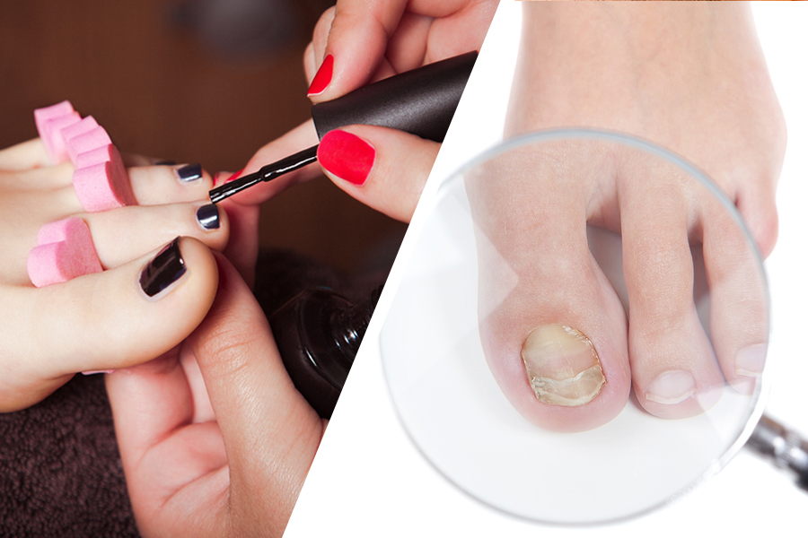 Chipping Nail Polish Causes Dryness