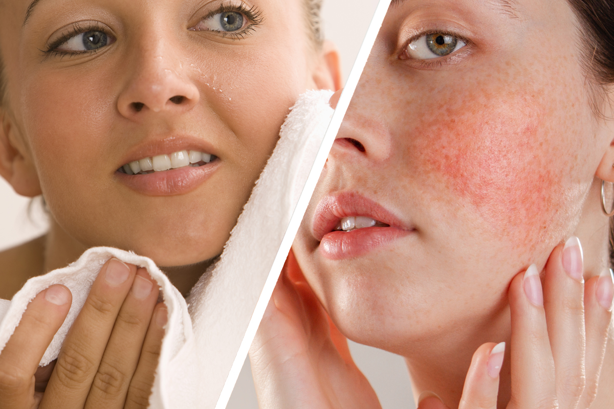 Abrasive Washcloths Cause Inflammation