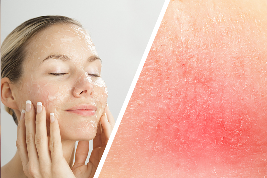 Daily Exfoliation Damages The Skin