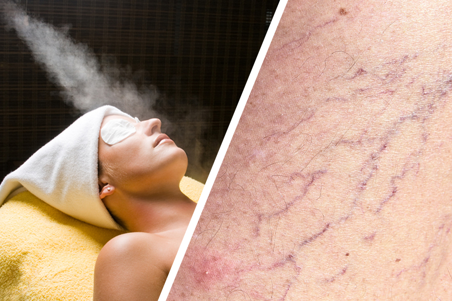 Steam Cleaning Causes Dry Skin, Breakouts, And Broken Capillaries