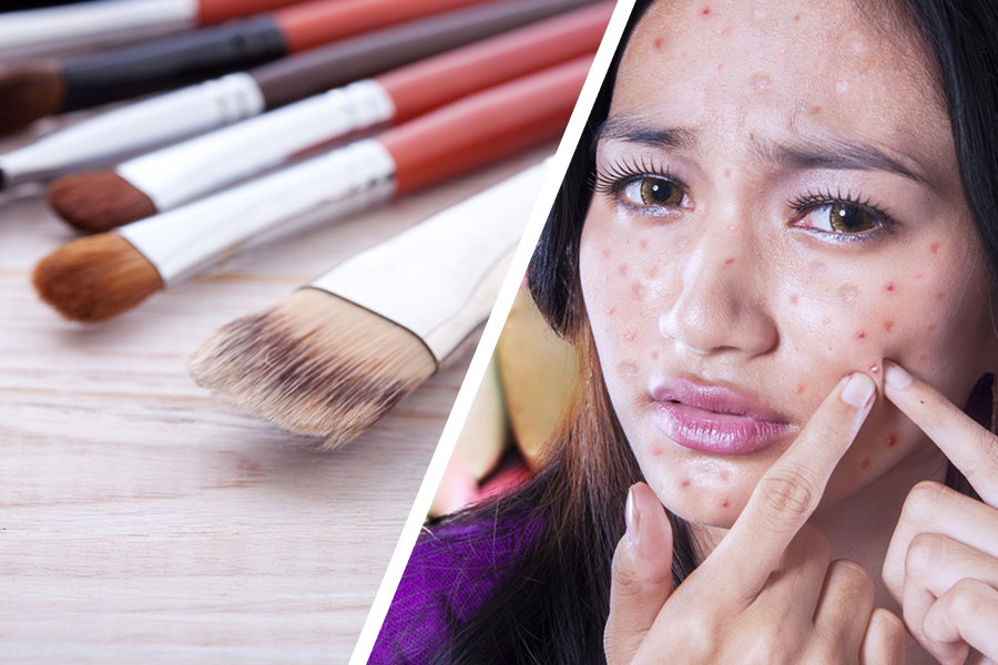 Dirty Makeup Brushes Cause Acne