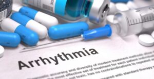 An app for detecting arrhythmias