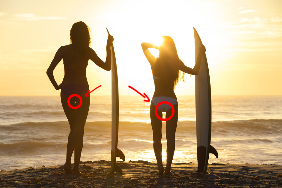 Thigh Gap