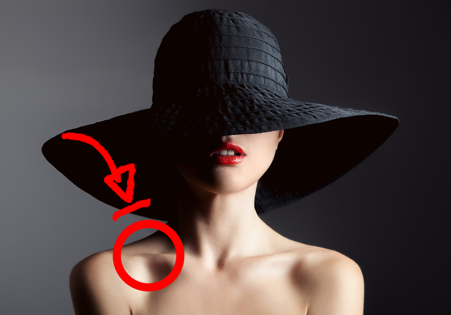 Protruding Collarbones