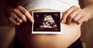 A woman with her ultrasound